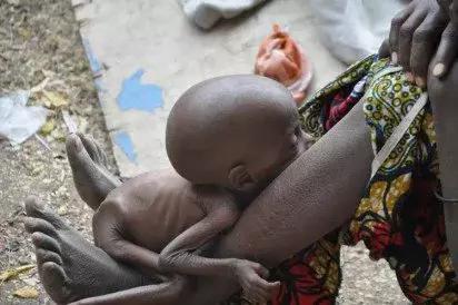 Tragedy of Nigeria's poverty scourge