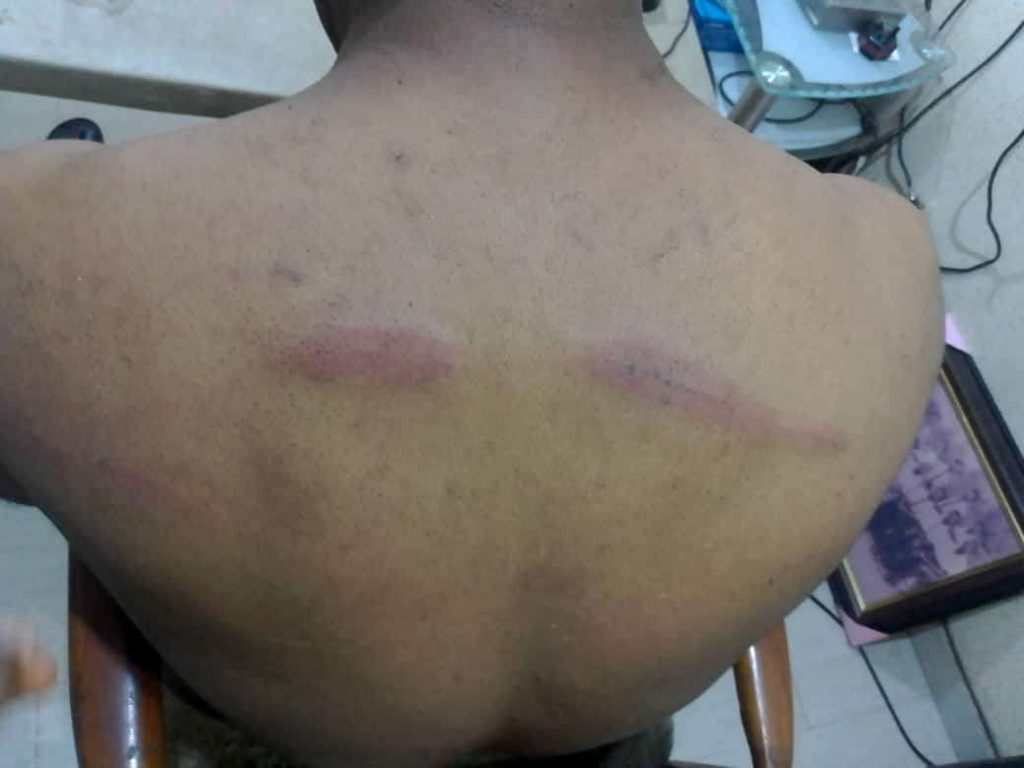'Ebube Agu' operatives, torture, detain Abia Onyike, ex-Ebonyi commissioner