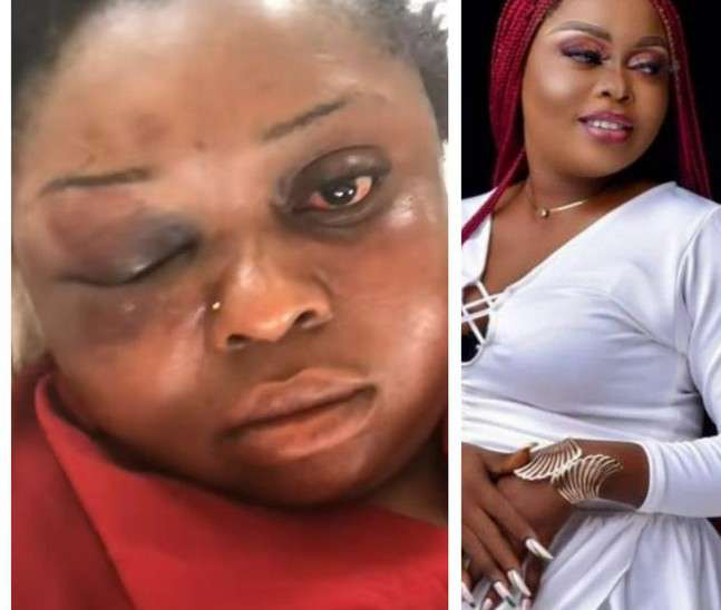 Man beats up girlfriend for turning down marriage proposal