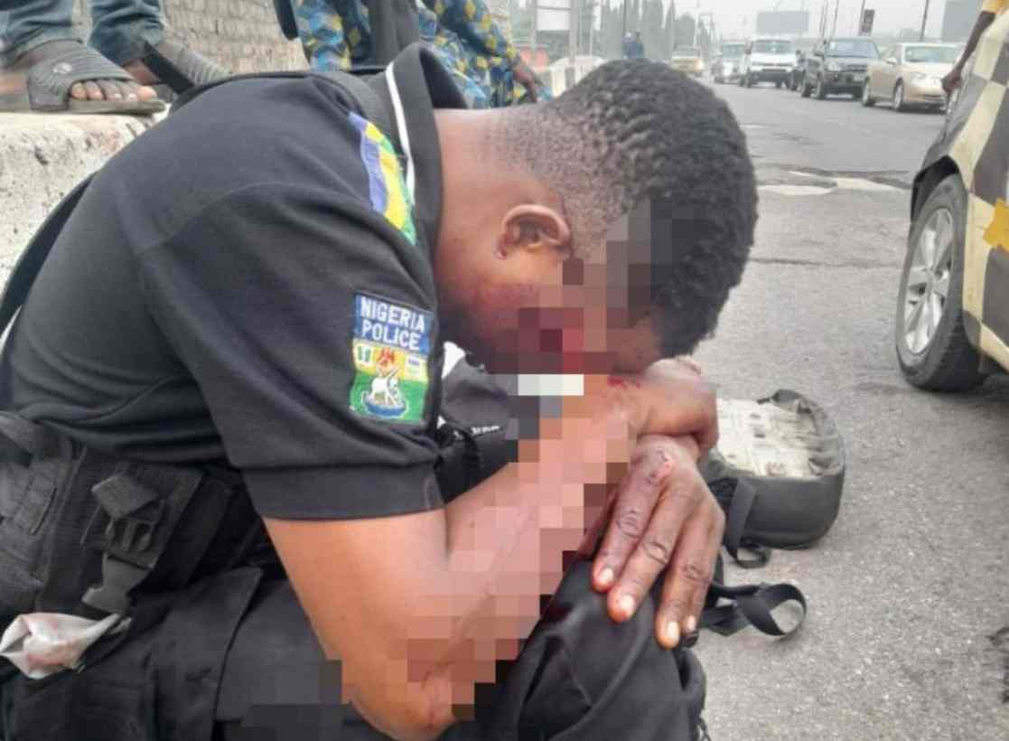 Hit-and-run driver injures policeman in Lagos