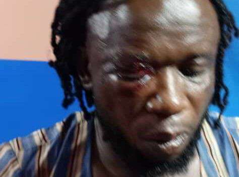 Musician assaulted for refusing to sing APC songs at burial ceremony in Ebonyi