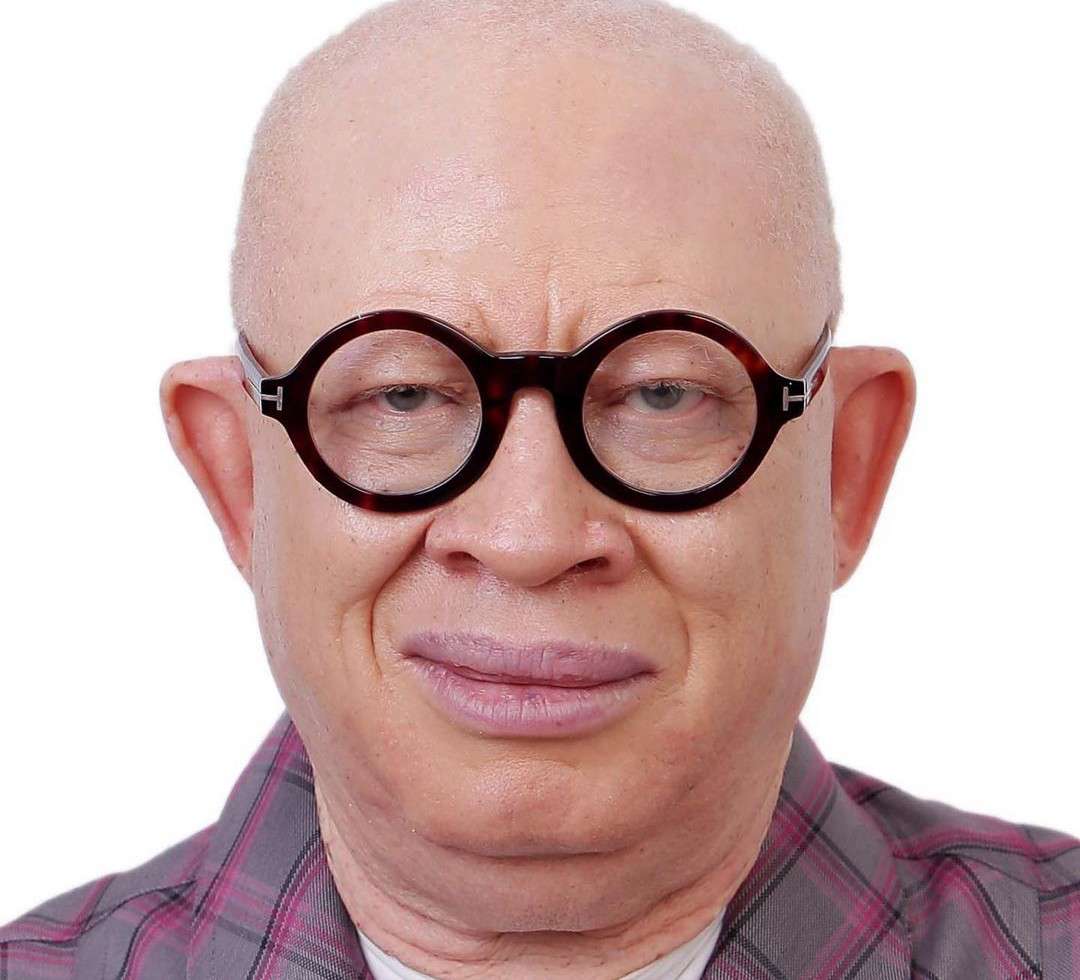 Albinos, “Afin” are derogatory names, instead call us persons with Albinism - Jake Epelle, TAF Africa founder