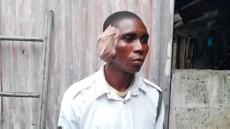 Angry driver bites off VIO officer's ear in Delta
