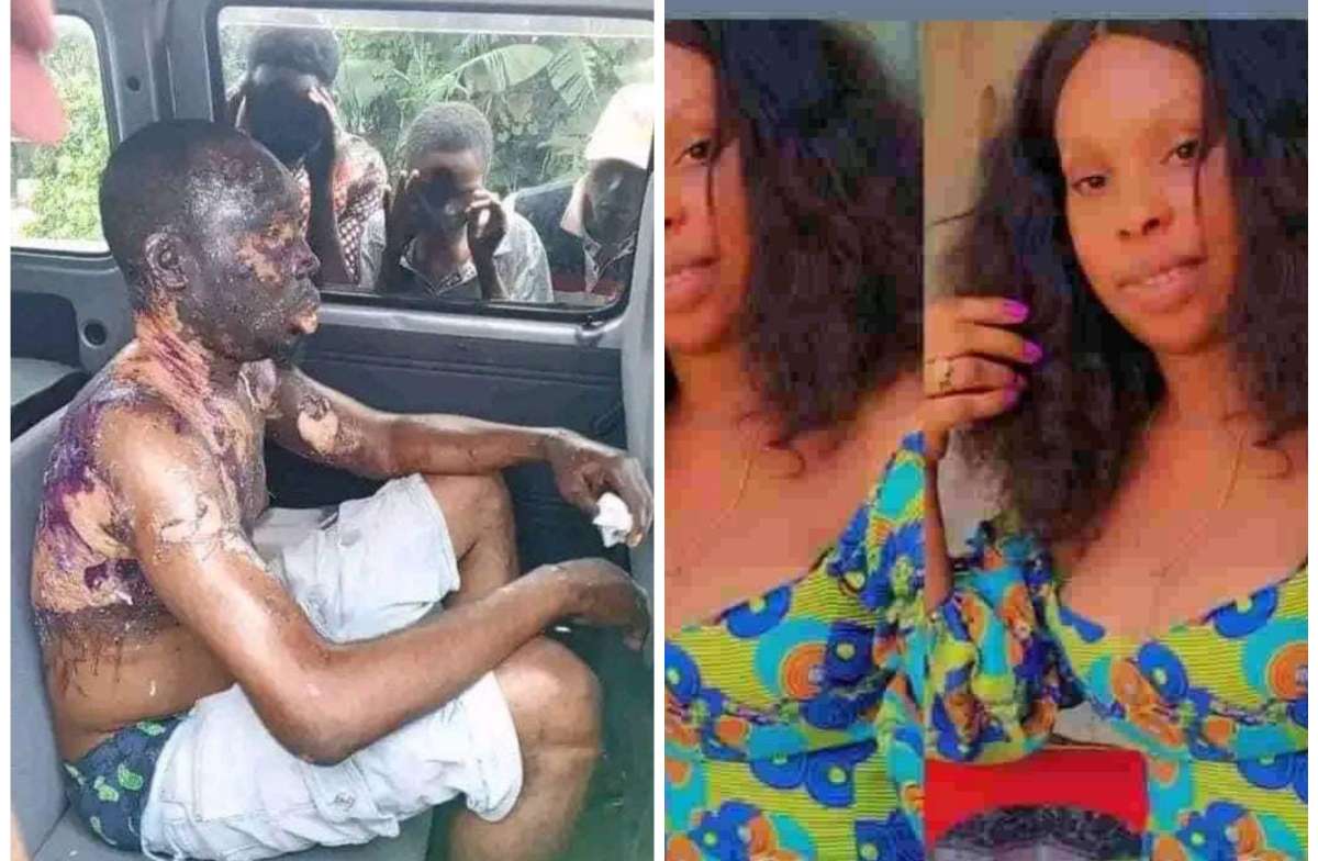 Man battles for life as wife bathes him with hot oil in Rivers
