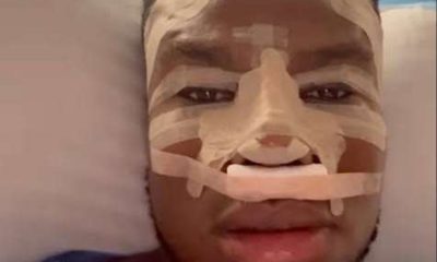 Zicsaloma goes for nose surgery in Istanbul