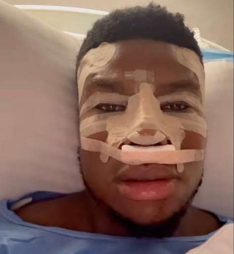 Zicsaloma goes for nose surgery in Istanbul