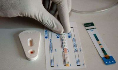 Rivers, Benue, Akwa Ibom Lead in Nigeria’s 2 Million HIV Cases – NACA