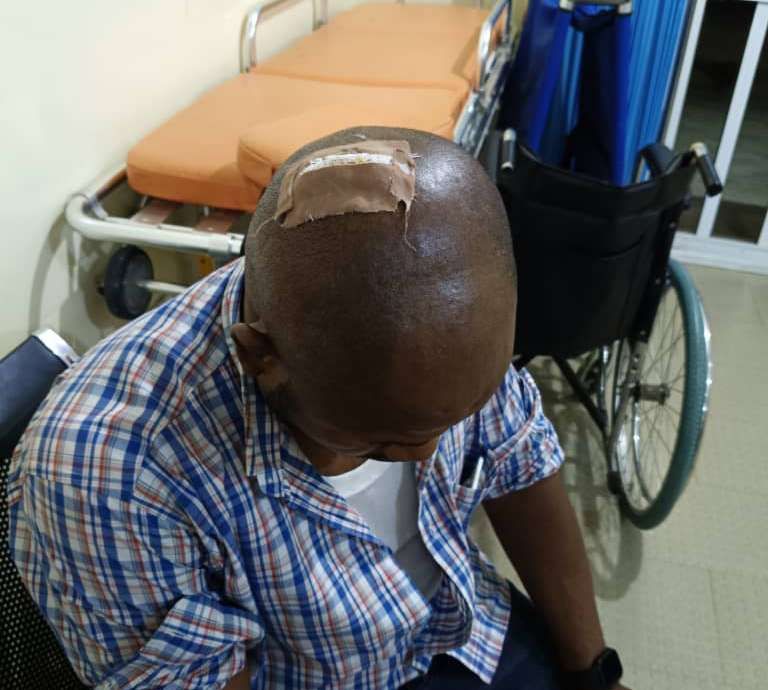 AEDC Officials Attacked During Anti-Power Theft Enforcement in Abuja Estate
